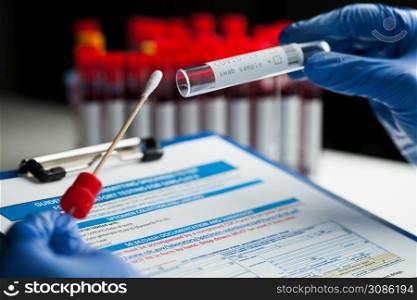 Lab technician holding swab collection kit,Coronavirus COVID-19 specimen collecting equipment,DNA nasal and oral swabbing for PCR polymerase chain reaction laboratory testing procedure and shipping