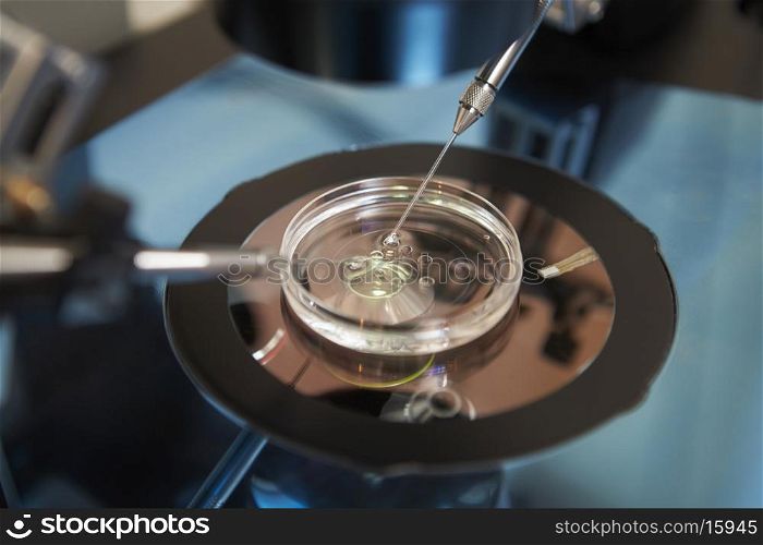 Laboratory Fertilization Of Eggs In IVF Treatment