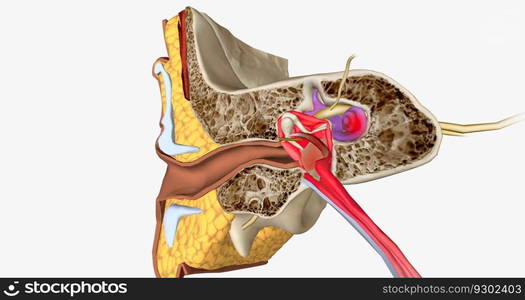 Labyrinthitis is an infection and inflammation of the inner ear and the nerves that connect the inner ear to the brain. 3D rendering. Labyrinthitis is an infection and inflammation of the inner ear and the nerves that connect the inner ear to the brain.