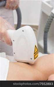 Laser epilation of armpits, hair removal cosmetology procedure. Health and beauty concept.. Laser epilation of armpits