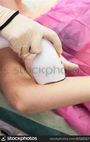 Laser epilation or photo epilation of woman hand