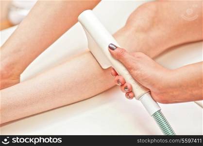Laser hair removal on ladies legs