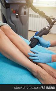 laser legs epilation. Laser hair removal on ladies legs
