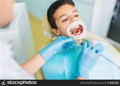 Little boy with open mouth in a dental cabinet, caries removal procedure, pediatric dentistry. Female dentist looking for caries. Boy in a dental cabinet, caries removal