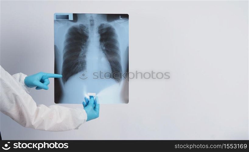 Lungs x-ray film in doctor hands wearing medical gloves and PPE suit which showing scan-film of uncommon respiratory syndrome or pneumonia disease or unhealthy-lung that infected by Coronavirus or Covid-19
