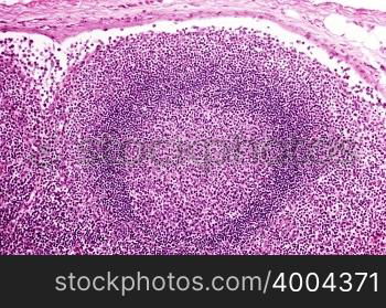 Lymph node