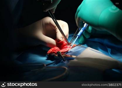 Macro shot of an infant lung surgery