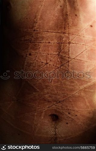 Male abdomen with scars from cuts closeup&#xA;