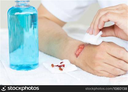 Man cleaning lesion or wound on his arm with alcohol for disinfect