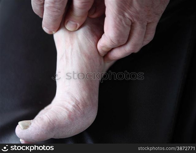 man&rsquo;s hands on his painful foot