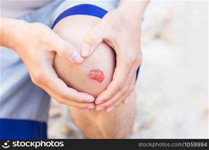 Man show red lesion or wound on his knee after accident