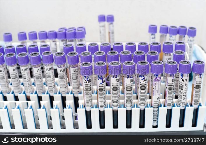 many test tubes with donor blood being tested