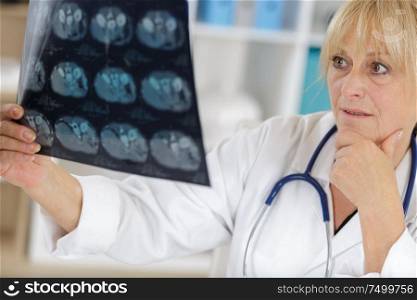 mature female doctor looking at x-ray image