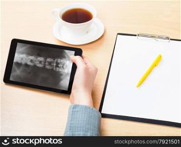 medic analyzes X-ray picture of vertebral column on screen on tablet pc