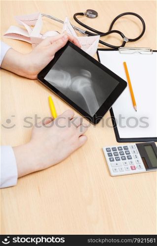medic examines X-ray picture of human knee joint on tablet pc