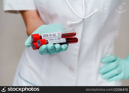 medical doctor nurse woman wearing protective mask and gloves - holding virus blood test tube.. medical doctor nurse woman wearing protective mask and gloves - holding virus blood test tube