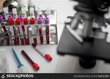 Medical equipment. Blood sample test in medical laboratory