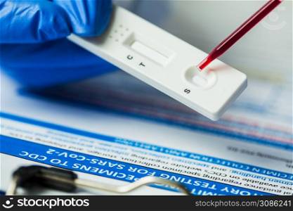 Medical laboratory technician placing blood sample specimen on quick rapid diagnostic test using pipette,Coronavirus infected patient antibodies diagnosis,UK NHS SARS-CoV-2 point of care fast testing