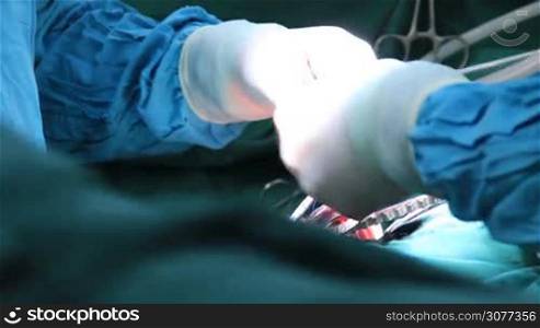 Medical team performing operation. Group of surgeons at work in operating theater. Closeup of gloved hands holding surgical scissors during surgery.