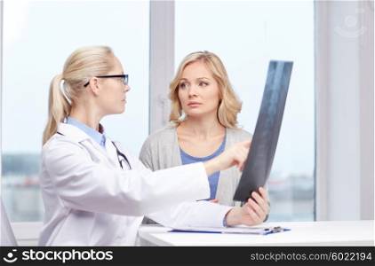 medicine, age, health care and people concept - woman patient and doctor with spine x-ray scan meeting in medical office