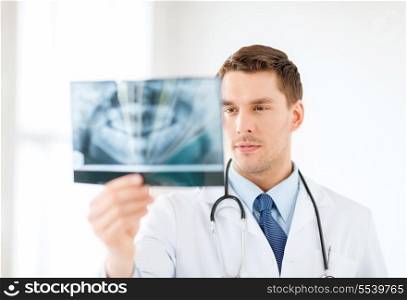 medicine and healthcare concept - concerned male doctor or dentist looking at x-ray in hospital