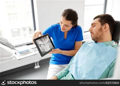 medicine, dentistry and healthcare concept - female dentist showing teeth panoramic x-ray scan on tablet pc computer to male patient at dental clinic. dentist showing panoramic dental x-ray to patient