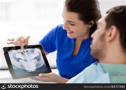 medicine, dentistry and healthcare concept - female dentist with tablet pc computer showing teeth x-ray to male patient at dental clinic office. dentist and patient with teeth x-ray on tablet pc. dentist and patient with teeth x-ray on tablet pc