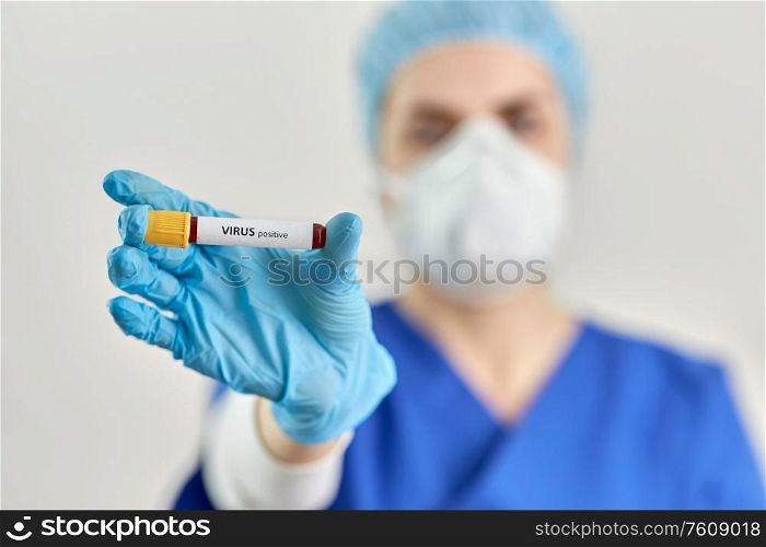 medicine, health and pandemic concept - close up of young female doctor or nurse holding beaker with virus positive blood test. doctor holding beaker with virus blood test