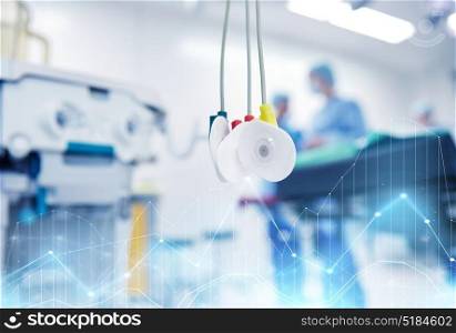 medicine, health care, electrocardiography, emergency and medical equipment concept - electrodes at hospital ward or operating room. electrodes at hospital ward or operating room