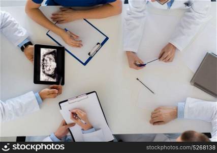 medicine, healthcare and oral surgery concept - group of doctors or surgeons discussing jaw x-ray on tablet pc computer screen at hospital or face and jaw surgery center. doctors with jaw x-ray on tablet pc at clinic
