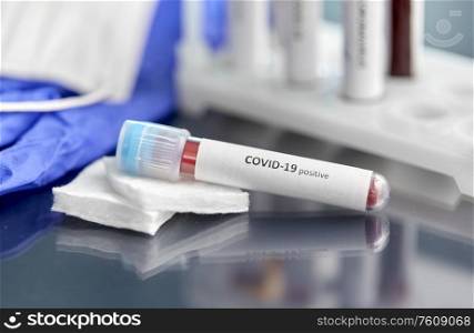 medicine, healthcare and pandemic concept - close up of beaker with coronavirus blood test on table at laboratory. beaker with coronavirus blood test at laboratory