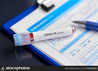 medicine, healthcare and pandemic concept - close up of beaker with positive coronavirus blood test and clipboard on table at hospital. close up of beaker with coronavirus blood test