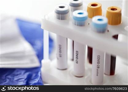 medicine, healthcare and pandemic concept - close up of beakers with coronavirus blood test in holder at laboratory. beakers with coronavirus blood test in holder