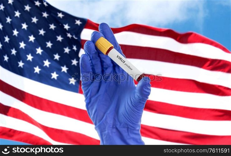 medicine, healthcare and pandemic concept - close up of hand in protective medical glove holding beaker with positive virus blood test over flag of america. hand holding beaker with positive virus blood test