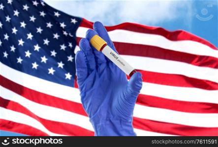 medicine, healthcare and pandemic concept - close up of hand in protective medical glove holding beaker with positive virus blood test over flag of america. hand holding beaker with positive virus blood test