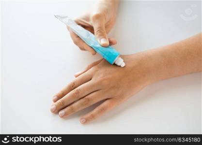 medicine, healthcare and people concept - close up of woman hands applying cream or therapeutic salve. close up of hands with cream or therapeutic salve