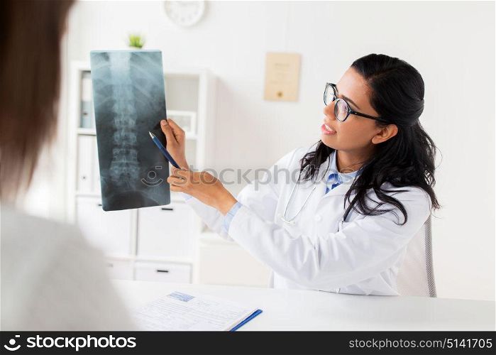 medicine, healthcare and people concept - doctor showing x-ray of spine to woman patient at hospital. doctor with x-ray of spine and patient at hospital