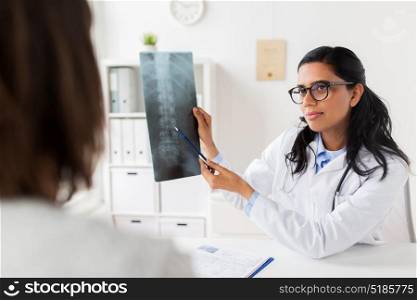 medicine, healthcare and people concept - doctor showing x-ray of spine to woman patient at hospital. doctor with x-ray of spine and patient at hospital