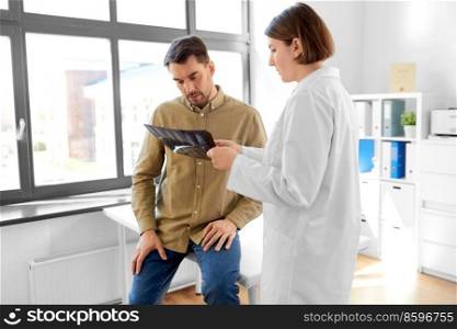 medicine, healthcare and people concept - female doctor showing x-ray to male patient at medical office in hospital. doctor showing x-ray to male patient at hospital