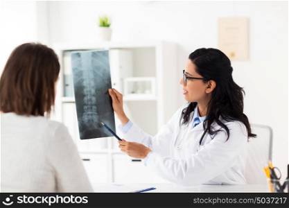 medicine, healthcare and people concept - woman patient and doctor with spine x-ray scan meeting at hospital. doctor and patient with spine x-ray at hospital