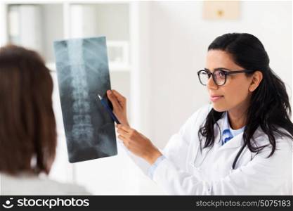 medicine, healthcare and people concept - woman patient and doctor with spine x-ray scan meeting at hospital. doctor and patient with spine x-ray at hospital