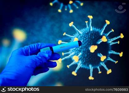 medicine, healthcare and science concept - close up of hand in protective medical glove holding beaker with virus positive blood test over coronavirus on background. hand holding beaker with coronavirus blood test