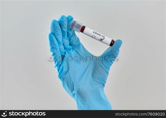 medicine, healthcare and virus concept - close up of hand in protective medical glove holding beaker with coronavirus blood test. hand holding beaker with coronavirus blood test