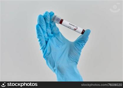 medicine, healthcare and virus concept - close up of hand in protective medical glove holding beaker with coronavirus blood test. hand holding beaker with coronavirus blood test