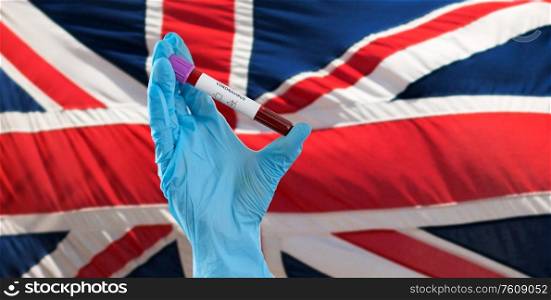 medicine, healthcare and virus concept - close up of hand in protective medical glove holding beaker with coronavirus blood test over flag of england on background. hand holding beaker with coronavirus blood test