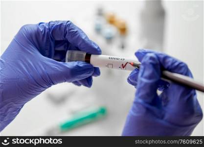 medicine, healthcare and virus concept - close up of hand in protective medical glove drawing check mark on beaker with coronavirus blood test. hand holding beaker with coronavirus blood test