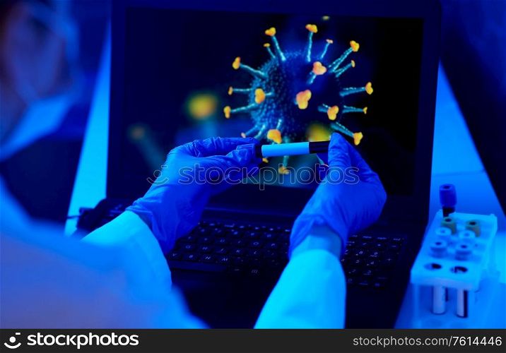 medicine, healthcare and virus concept - close up of hand in protective medical glove holding beaker with blood test over coronavirus on laptop computer screen at laboratory. hand holding beaker with coronavirus blood test