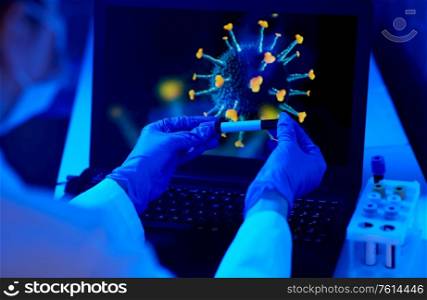 medicine, healthcare and virus concept - close up of hand in protective medical glove holding beaker with blood test over coronavirus on laptop computer screen at laboratory. hand holding beaker with coronavirus blood test