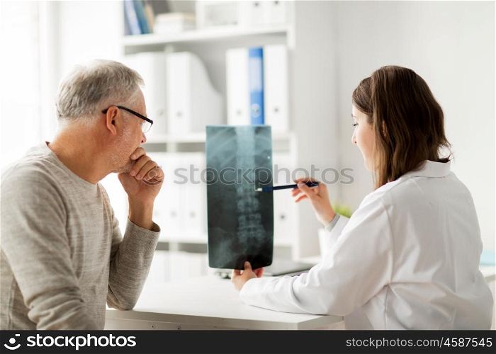 medicine, healthcare, surgery, radiology and people concept - doctor showing x-ray of spine to senior man at hospital