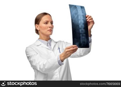 medicine, radiology and healthcare concept - female doctor in white coat with x-ray scan image of spine. female doctor with x-ray of spine
